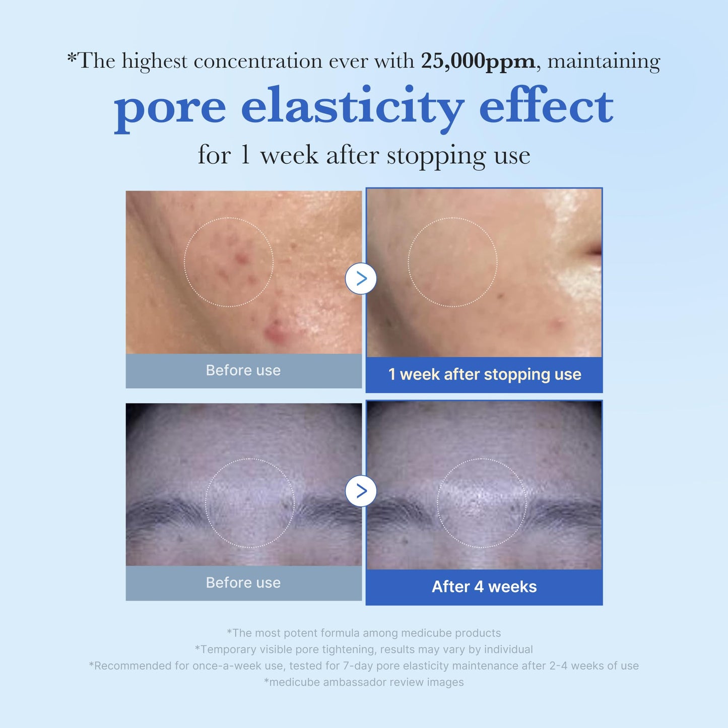 Medicube Exosome Shot 25000ppm Serum, Korean Skincare for Pores